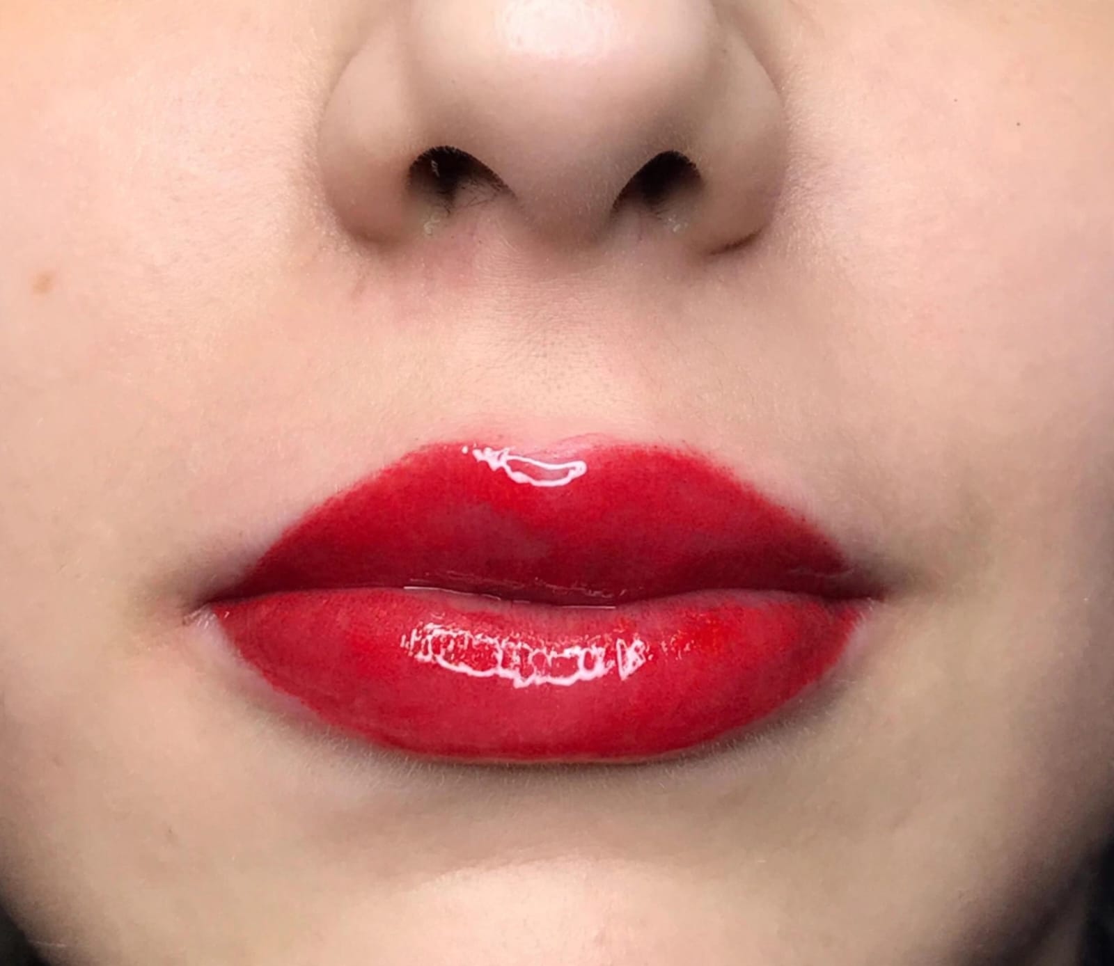 Tratamiento de Lip Blush